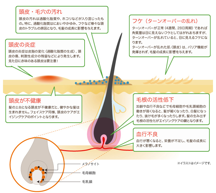 頭皮トラブルの原因