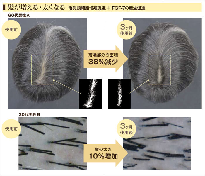 髪が増える・太くなる（毛乳頭細胞増殖促進＋FGF-7の生産促進）