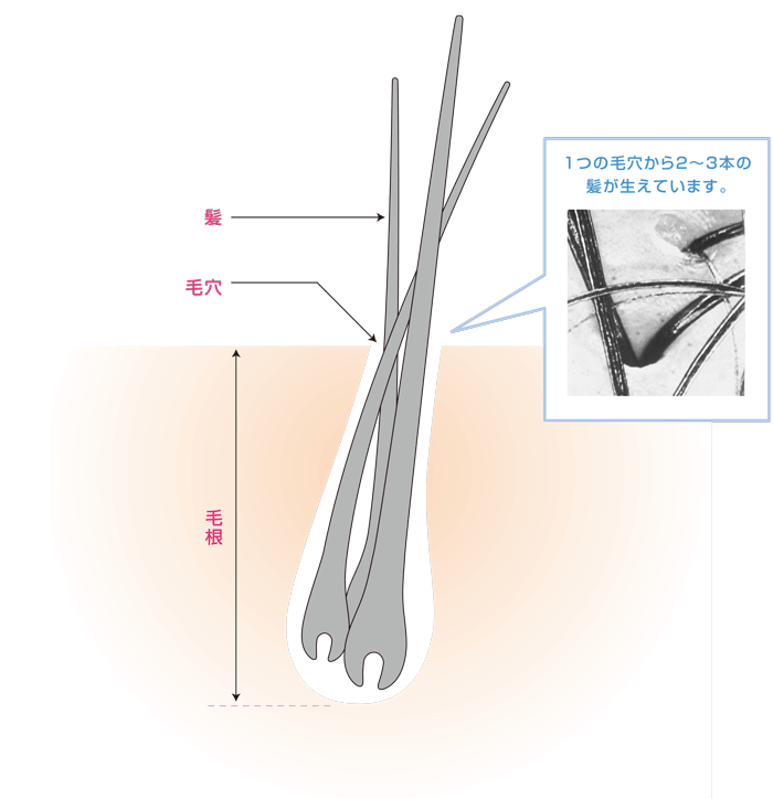 髪の生え方