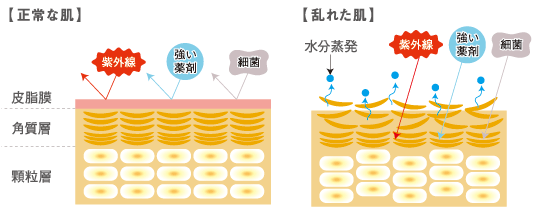 正常な肌と乱れた肌