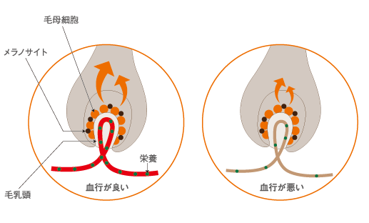 血行が良い毛根と血行が悪い毛根のイメージ