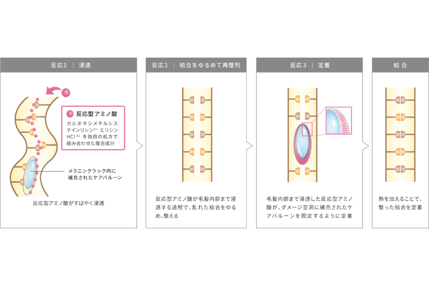 ボンデイドシステムのイメージ写真