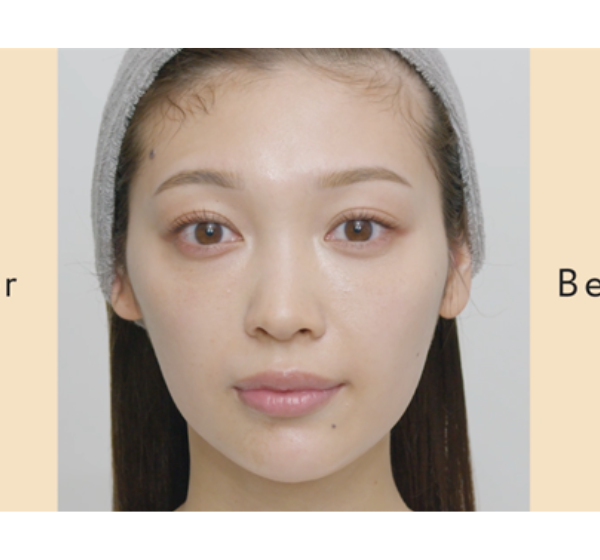 顔のむくみ解消に】リフトアップ効果も期待できる美容ギアの