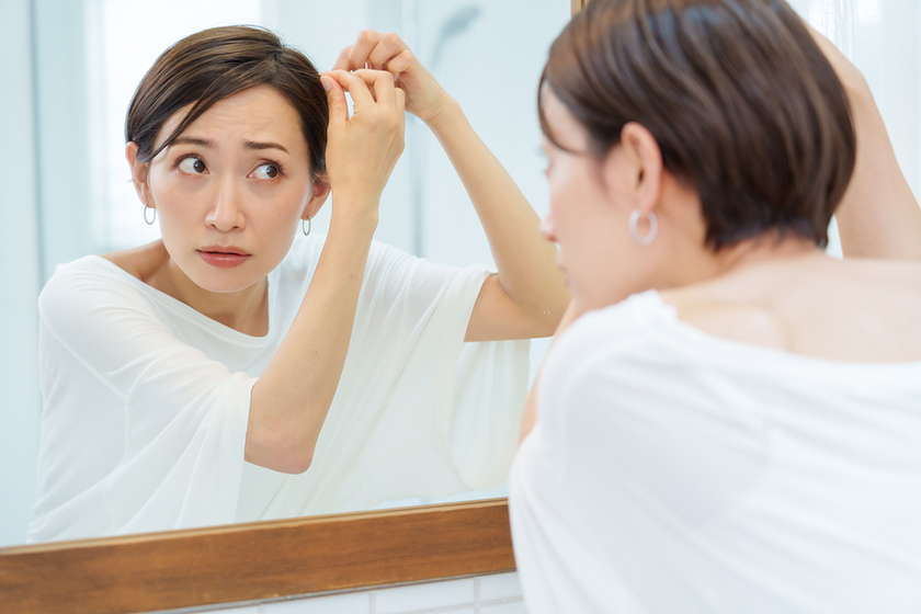 ストレスで抜け毛が生じる原因の画像