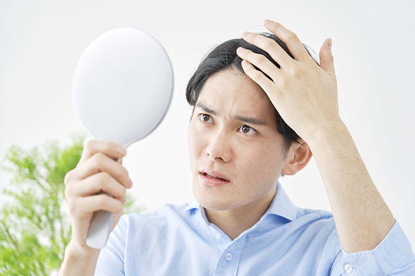 薄毛の原因の画像