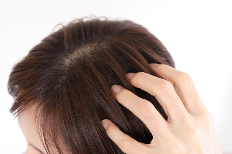 バイオフィルムってなに？頭皮のバイオフィルムの原因・影響と予防法を解説の写真